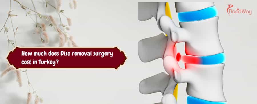 Disc removal surgery cost in Turkey