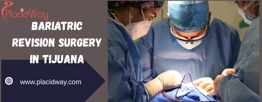 bariatric revision surgery in Tijuana