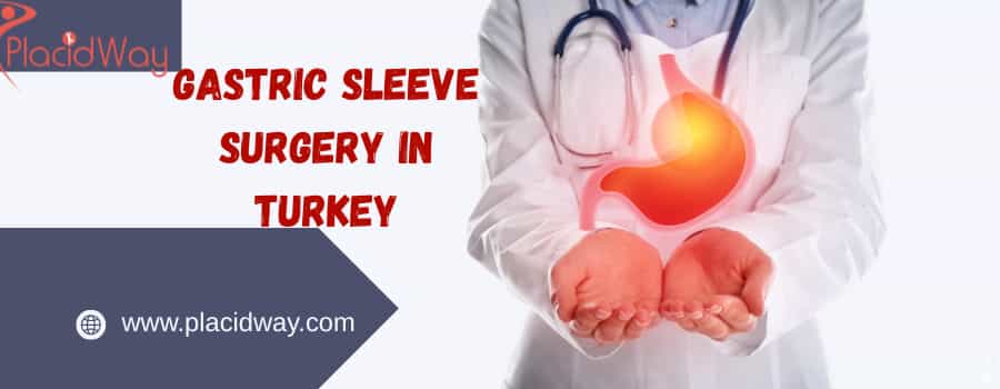 gastric sleeve 