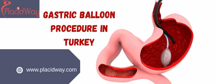 gastric balloon procedure in Turkey