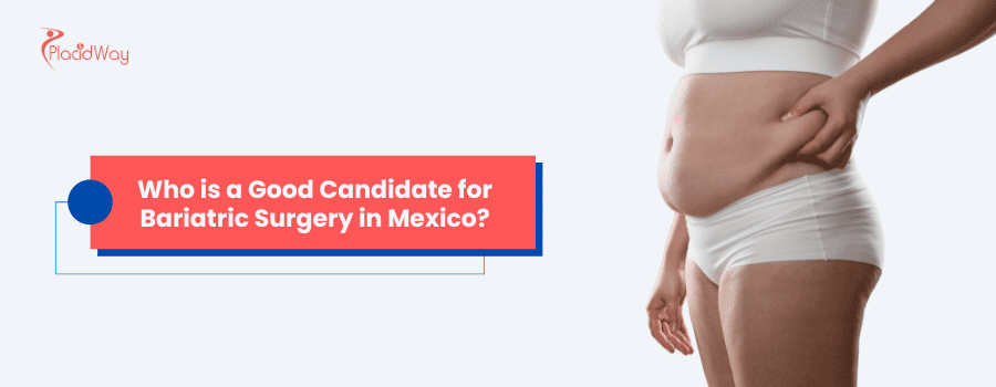 Who is a Good Candidate for Bariatric Surgery in Mexico?