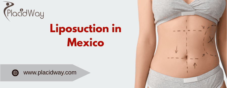 liposuction in Mexico