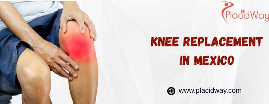 knee replacement in Mexico