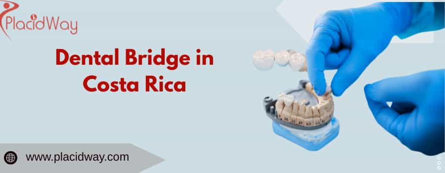 Dental Bridge in Costa Rica