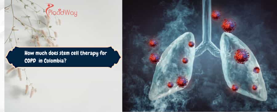 stem cell therapy for COPD  in Colombia
