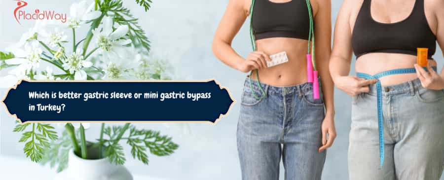 gastric sleeve or mini gastric bypass in Turkey