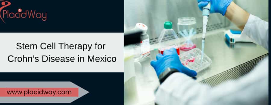 stem cell therapy for Crohn’s disease in Mexico