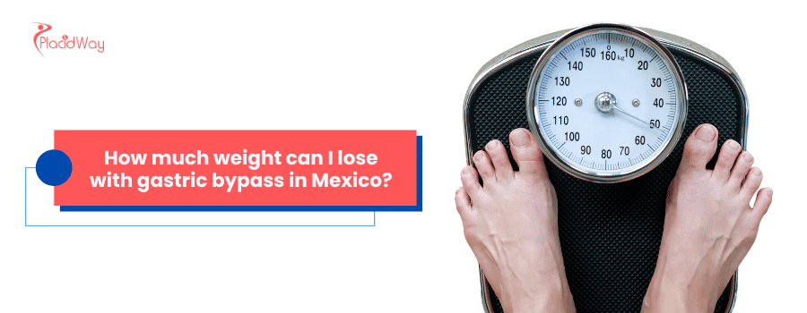 How much weight can I lose with Gastric Bypass in Mexico?