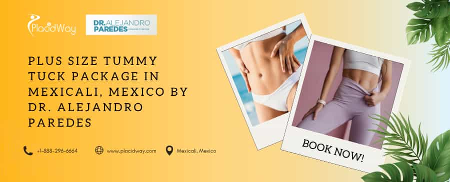 Tummy Tuck Mexicali – Plus Size Tummy Tuck Package by Dr. Alejandro Paredes in Mexico