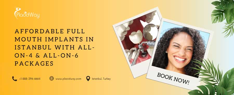 Affordable Full Mouth Implants in Istanbul