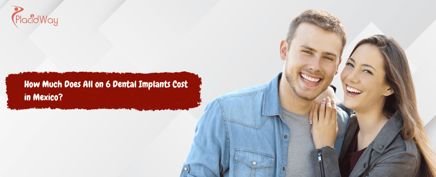 All on 6 Dental Implants Cost in Mexico