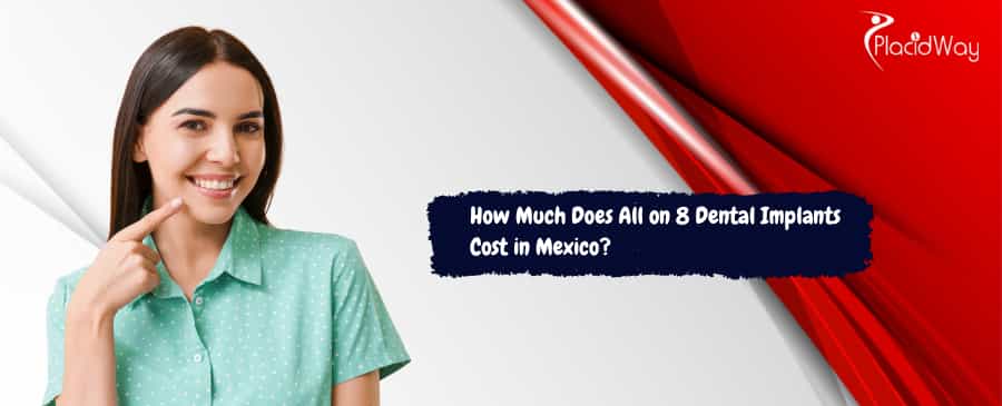 all on 8 dental implant in Mexico