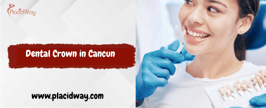 Cost of a Zirconia Crown in Cancun