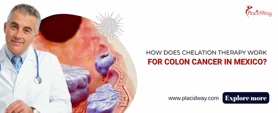 How Does Chelation Therapy Work For Colon Cancer In Mexico