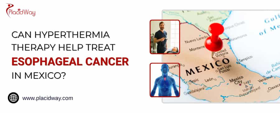 Can Hyperthermia Therapy Help Treat Esophageal Cancer In Mexico