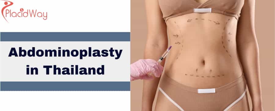 Abdominoplasty in Thailand