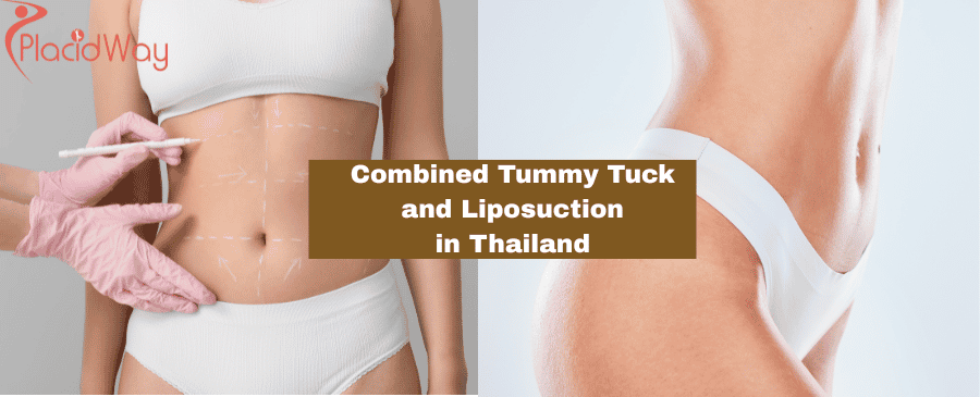 Combined Tummy Tuck  and Liposuction  in Thailand