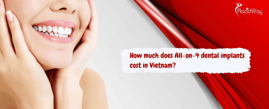 How much does All-on-4 dental implants cost in Vietnam?