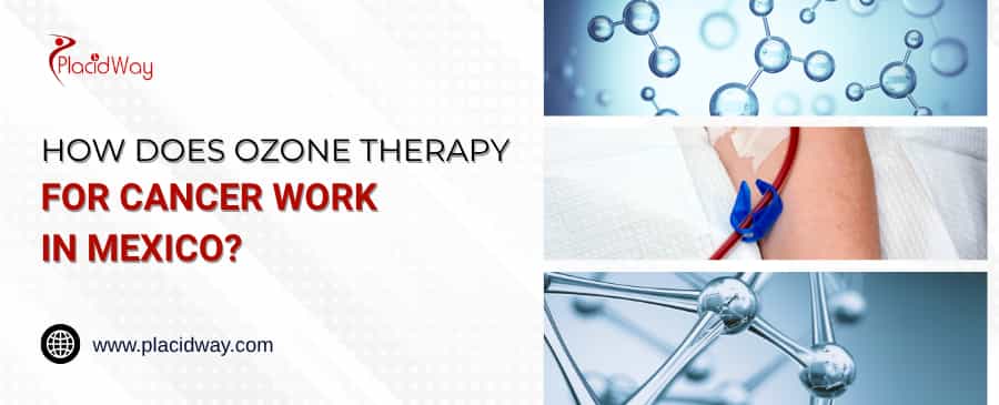 How Does Ozone Therapy For Cancer Work In Mexico