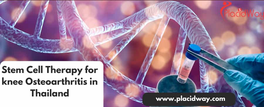 Stem Cell Therapy for knee Osteoarthritis in Thailand