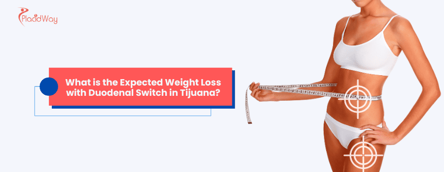What is the Expected Weight Loss with Duodenal Switch in Tijuana?