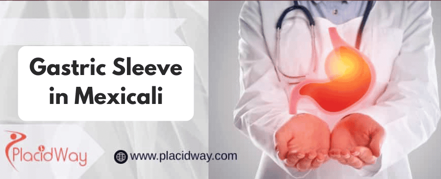 gastric sleeve in Mexicali