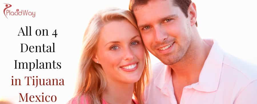 All-on-4 Dental Implant