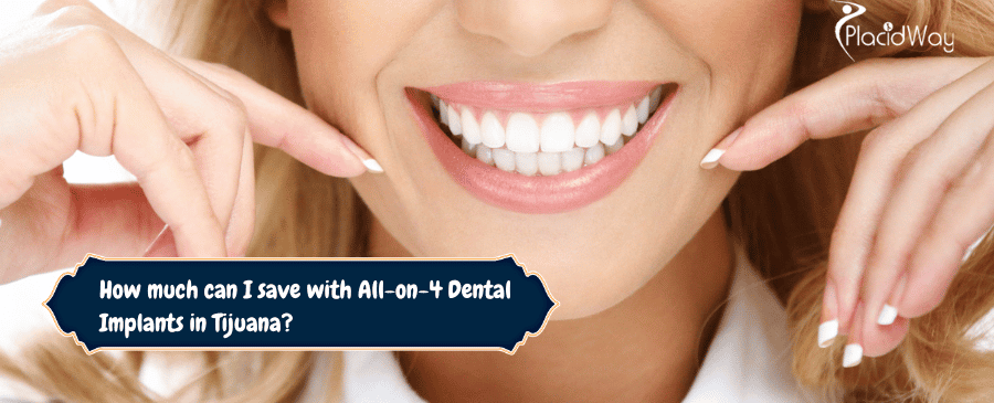 How Much can I Save with All-on-4  Dental Implants in Tijuana