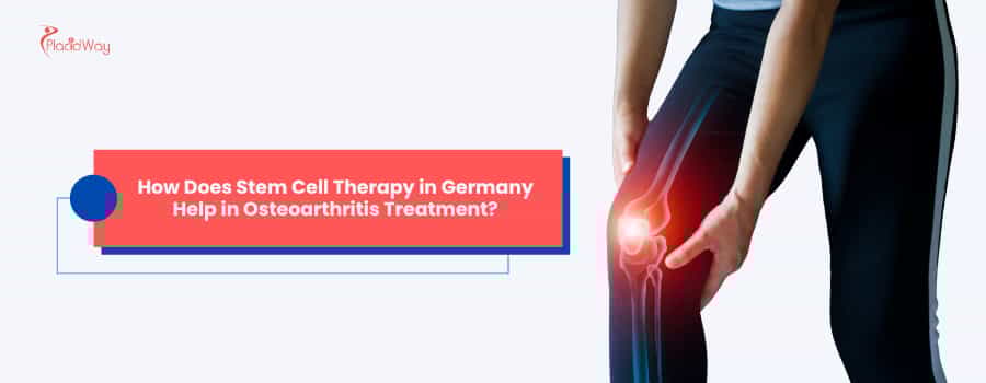 How Does Stem Cell Therapy in Germany Help in Osteoarthritis Treatment?