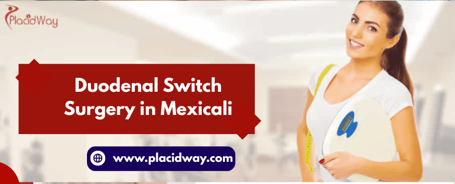 Duodenal Switch Surgery in Mexicali