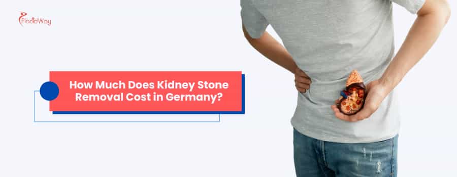 How Much Does Kidney Stone Removal Cost in Germany?