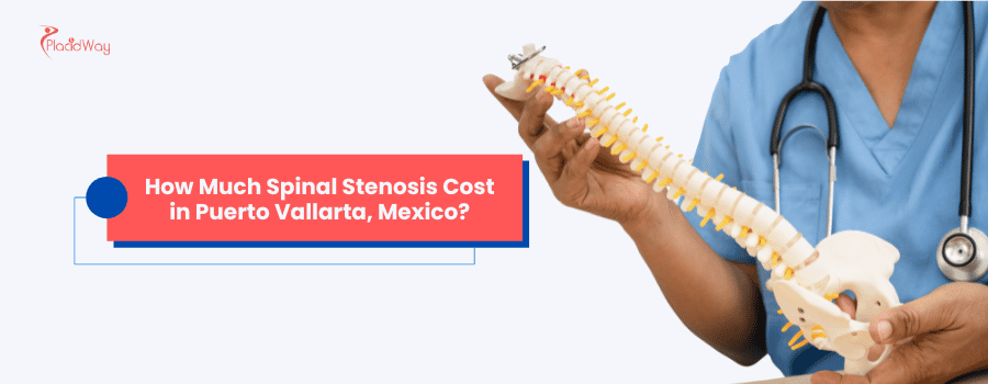 How Much Spinal Stenosis Cost in Puerto Vallarta Mexico?