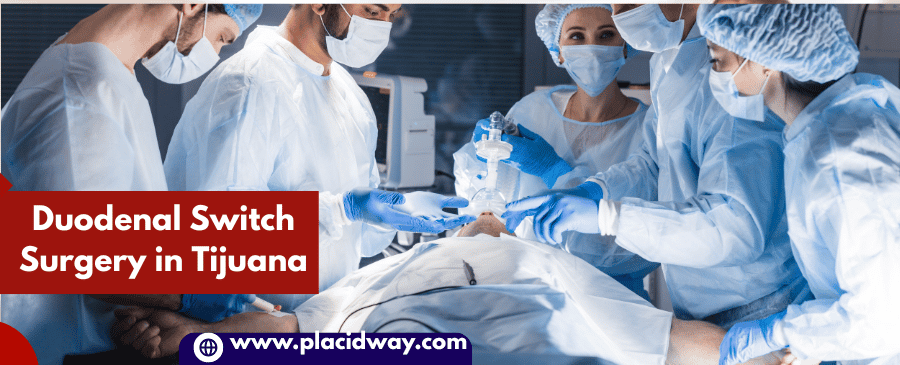 Duodenal Switch Surgery in Tijuana