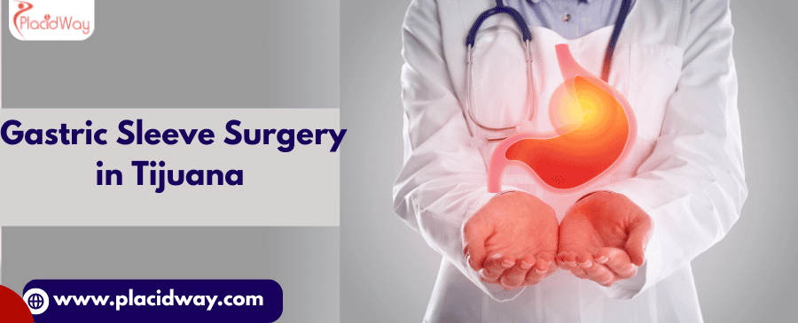 Gastric Sleeve Surgery in Tijuana