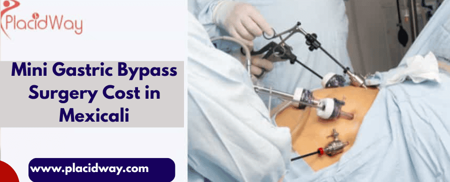 Mini Gastric Bypass Surgery Cost in Mexicali
