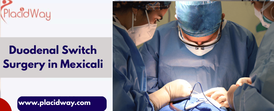 Duodenal Switch Surgery in Mexicali