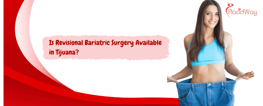 revision bariatric surgery in Tijuana