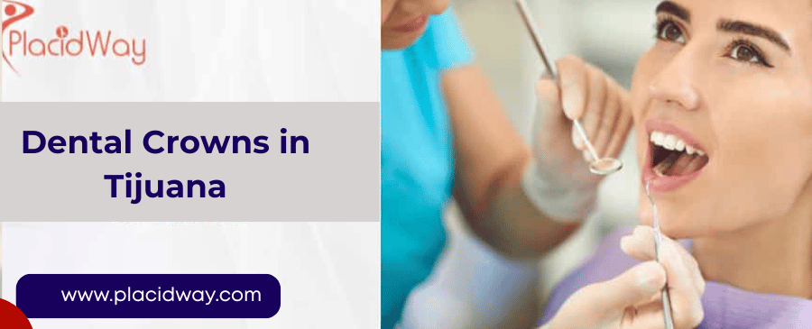 Dental Crowns in Tijuana