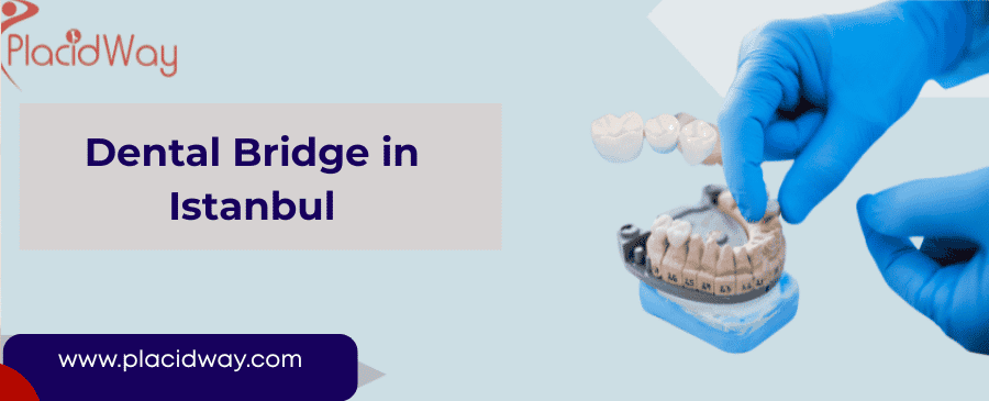 dental bridge in Istanbul