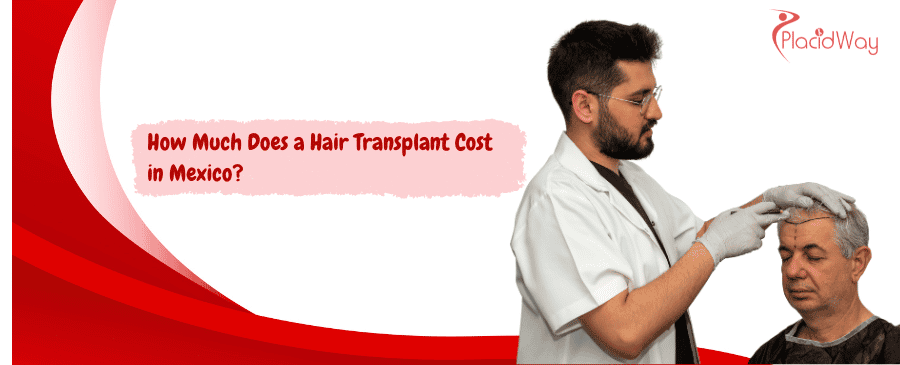 Hair Transplant Cost in Mexico