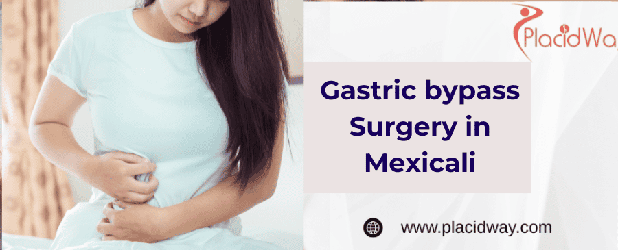 gastric bypass surgery in Mexicali