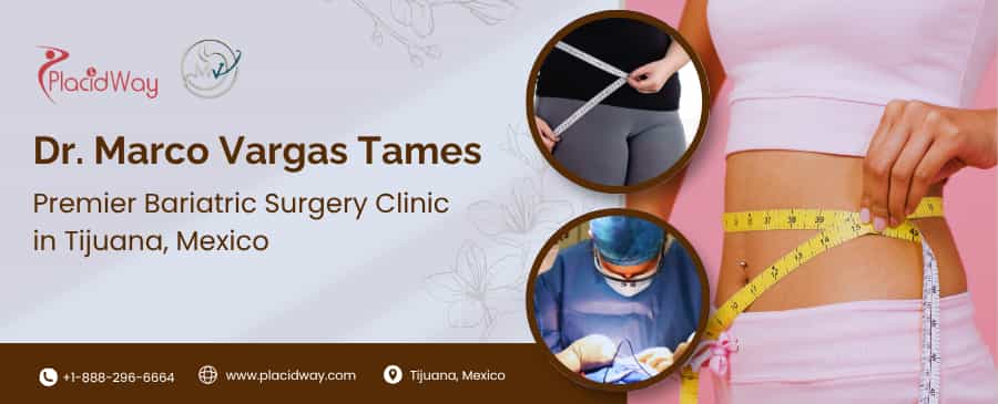 Dr. Marco Vargas Tames - Cirugía Bariátrica en Tijuana, México