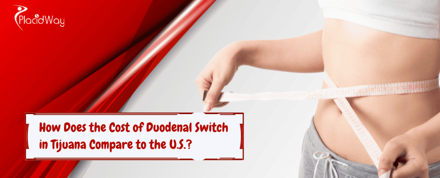 Duodenal Switch in Tijuana Compare to the U.S.