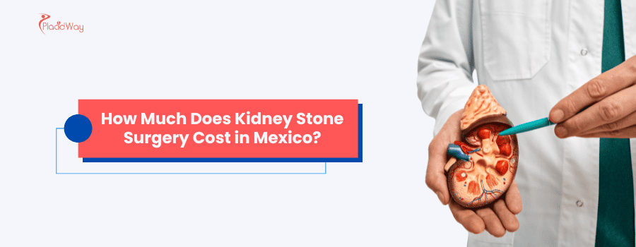 How Much Does Kidney Stone Surgery Cost in Mexico?