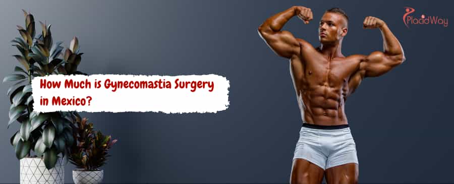 Gynecomastia Surgery in Mexico