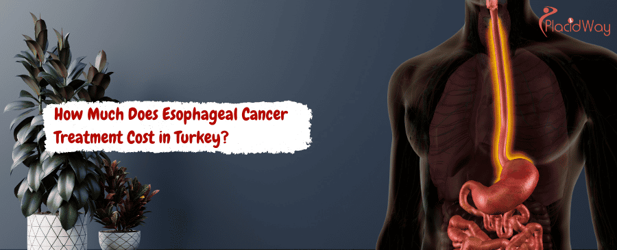 Esophageal Cancer Treatment Cost in Turkey