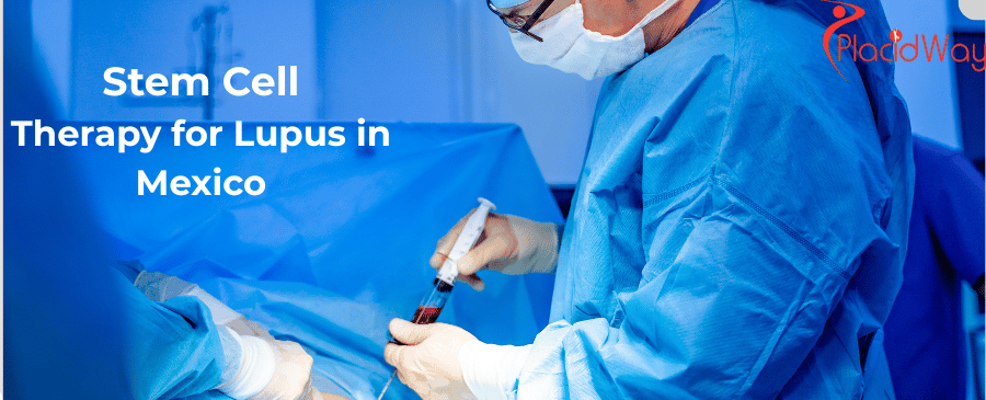 Stem Cell Therapy for Lupus in Mexico