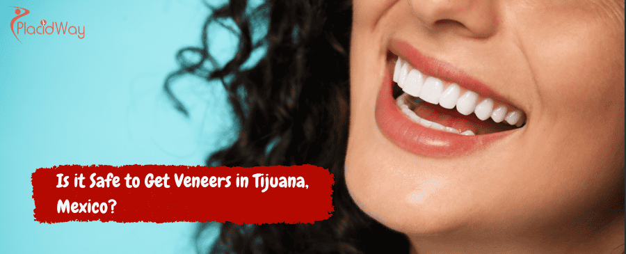 ¿Es seguro hacerse carillas en Tijuana, México?