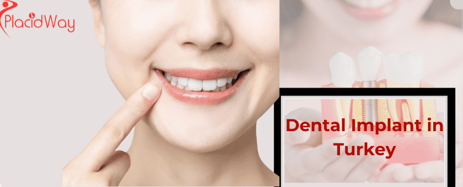 Dental Implant in Turkey