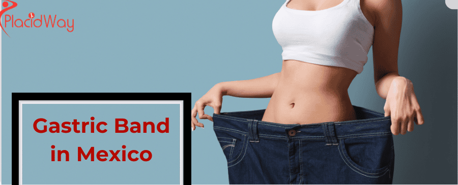Gastric Band in Mexico